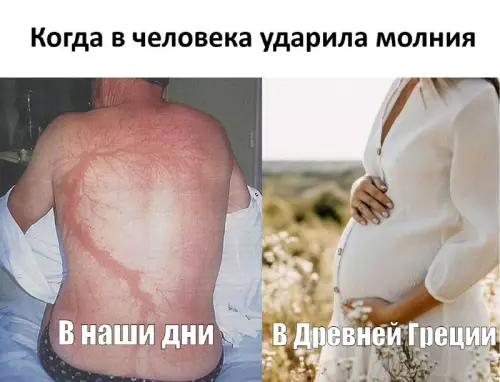 ⚡️ Молния в спину или греческие боги? 😂 - Когда в человека ударила молния. В наши дни. В Древней