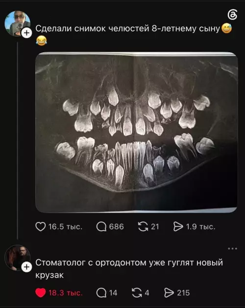 Когда зубов больше чем проблем 🦷😂 - Сделали снимок челюстей 8-летнему сыну Стоматолог с ортодонтом уже гуглят